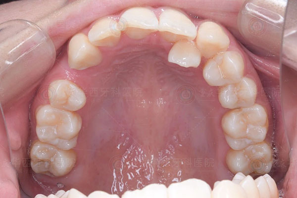 3c48a274fea0ece970bff0458cdc06c2